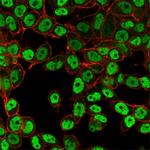 SMARCC1/BAF155 Antibody in Immunocytochemistry (ICC/IF)