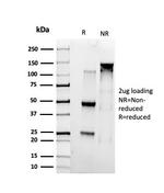 SMARCC1/BAF155 Antibody in SDS-PAGE (SDS-PAGE)