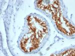 Fascin-1 (Reed-Sternberg Cell Marker) Antibody in Immunohistochemistry (Paraffin) (IHC (P))