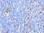 Fascin-1 (Reed-Sternberg Cell Marker) Antibody in Immunohistochemistry (Paraffin) (IHC (P))