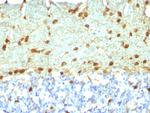 Fascin-1 (Reed-Sternberg Cell Marker) Antibody in Immunohistochemistry (Paraffin) (IHC (P))