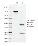 Superoxide Dismutase 1 (SOD1) (Antioxidant Enzyme) Antibody in SDS-PAGE (SDS-PAGE)