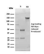 Superoxide Dismutase 1 (SOD1) (Antioxidant Enzyme) Antibody in SDS-PAGE (SDS-PAGE)