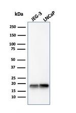 Superoxide Dismutase 1 (SOD1) (Antioxidant Enzyme) Antibody in Western Blot (WB)