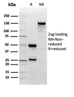 Superoxide Dismutase 1 (SOD1) (Antioxidant Enzyme) Antibody in SDS-PAGE (SDS-PAGE)