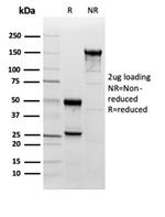 Superoxide Dismutase 1 (SOD1) (Antioxidant Enzyme) Antibody in Immunoelectrophoresis (IE)