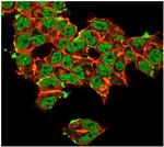 Superoxide Dismutase 1 (SOD1) (Antioxidant Enzyme) Antibody in Immunocytochemistry (ICC/IF)