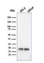 Superoxide Dismutase 1 (SOD1) (Antioxidant Enzyme) Antibody in Western Blot (WB)