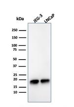 Superoxide Dismutase 1 (SOD1) (Antioxidant Enzyme) Antibody in Western Blot (WB)