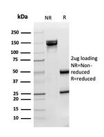 Superoxide Dismutase 1 (SOD1) (Antioxidant Enzyme) Antibody in SDS-PAGE (SDS-PAGE)