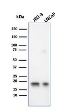 Superoxide Dismutase 1 (SOD1) (Antioxidant Enzyme) Antibody in Western Blot (WB)