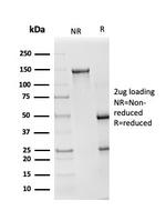 Superoxide Dismutase 1 (SOD1) (Antioxidant Enzyme) Antibody in SDS-PAGE (SDS-PAGE)