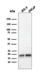 Superoxide Dismutase 1 (SOD1) (Antioxidant Enzyme) Antibody in Western Blot (WB)