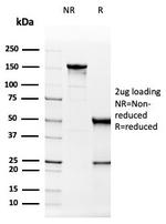 Superoxide Dismutase 1 (SOD1) (Antioxidant Enzyme) Antibody in SDS-PAGE (SDS-PAGE)