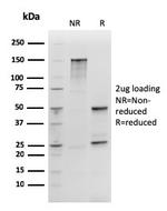 SOX2 (Embryonic Stem Cell Marker) Antibody in SDS-PAGE (SDS-PAGE)