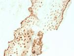 SOX2 (Embryonic Stem Cell Marker) Antibody in Immunohistochemistry (Paraffin) (IHC (P))