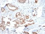 SOX4 (Master Regulator of Epithelial-Mesenchymal Transition) Antibody in Immunohistochemistry (Paraffin) (IHC (P))