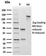 SOX4 (Master Regulator of Epithelial-Mesenchymal Transition) Antibody in SDS-PAGE (SDS-PAGE)