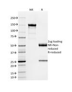 SOX9/SRY-box 9 Antibody in SDS-PAGE (SDS-PAGE)