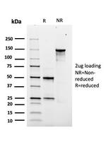 SOX9/SRY-box 9 Antibody in SDS-PAGE (SDS-PAGE)