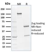 SOX9/SRY-box 9 Antibody in SDS-PAGE (SDS-PAGE)