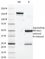 SOX10 (Melanoma Marker) Antibody in SDS-PAGE (SDS-PAGE)