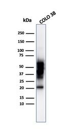 SOX10 (Melanoma Marker) Antibody in Western Blot (WB)