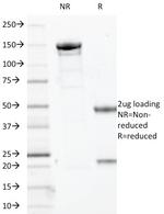 SOX10 (Melanoma Marker) Antibody in SDS-PAGE (SDS-PAGE)