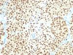 SOX10 (Melanoma Marker) Antibody in Immunohistochemistry (Paraffin) (IHC (P))