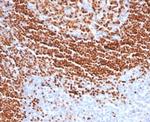 SOX11 (Mantle Cell Lymphoma Marker) Antibody in Immunohistochemistry (Paraffin) (IHC (P))