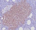 SOX11 (Mantle Cell Lymphoma Marker) Antibody in Immunohistochemistry (Paraffin) (IHC (P))