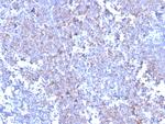 SOX11 (Mantle Cell Lymphoma Marker) Antibody in Immunohistochemistry (Paraffin) (IHC (P))