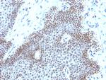 SOX11 (Mantle Cell Lymphoma Marker) Antibody in Immunohistochemistry (Paraffin) (IHC (P))