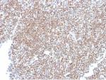 SP100 Antibody in Immunohistochemistry (Paraffin) (IHC (P))