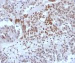 SP100 Antibody in Immunohistochemistry (Paraffin) (IHC (P))