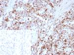 SPARC/Osteonectin Antibody in Immunohistochemistry (Paraffin) (IHC (P))