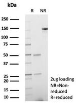 SPARC/Osteonectin Antibody in SDS-PAGE (SDS-PAGE)