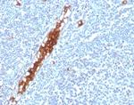 SPARC/Osteonectin Antibody in Immunohistochemistry (Paraffin) (IHC (P))