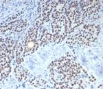 FOXL2 Antibody in Immunohistochemistry (Paraffin) (IHC (P))