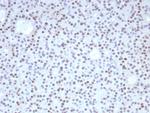 FOXL2 Antibody in Immunohistochemistry (Paraffin) (IHC (P))