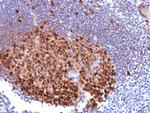 PU.1 (SPI-1) (B-Cell Marker) Antibody in Immunohistochemistry (Paraffin) (IHC (P))