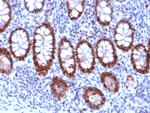 PU.1 (SPI-1) (B-Cell Marker) Antibody in Immunohistochemistry (Paraffin) (IHC (P))