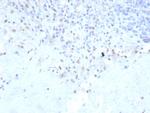 PU.1 (SPI-1) (B-Cell Marker) Antibody in Immunohistochemistry (Paraffin) (IHC (P))