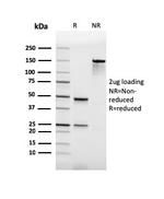 PU.1 (SPI-1) (B-Cell Marker) Antibody in Immunoelectrophoresis (IE)