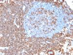 CD43 Antibody in Immunohistochemistry (Paraffin) (IHC (P))