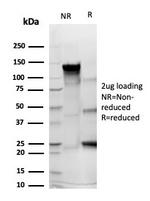 CD43 (T-Cell Marker) Antibody in Immunoelectrophoresis (IE)