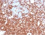 CD43 (T-Cell Marker) Antibody in Immunohistochemistry (Paraffin) (IHC (P))