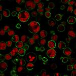 CD43 (T-Cell Marker) Antibody in Immunocytochemistry (ICC/IF)