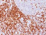 CD43 (T-Cell Marker) Antibody in Immunohistochemistry (Paraffin) (IHC (P))