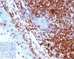 CD43 (T-Cell Marker) Antibody in Immunohistochemistry (Paraffin) (IHC (P))